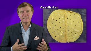 Acellular Dermal Matrix Complications Plastic Surgery Hot Topics with Rod J Rohrich MD [upl. by Calbert]