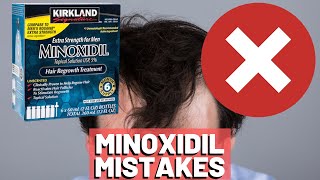 5 BIGGEST MISTAKES When Using Minoxidil REVEALED [upl. by Norak815]