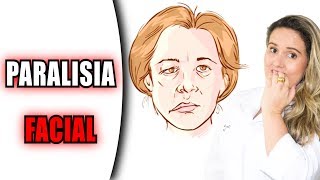 17 Dicas de Exercícios para Paralisia Facial [upl. by Wise]