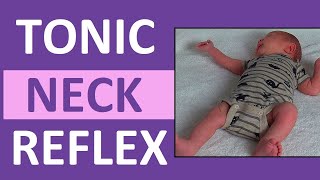 Rooting Reflex in Newborn Infant Baby  Pediatric Nursing Assessment [upl. by Hsiri]