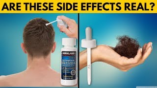 REAL TRUTH About Minoxidil Side Effects [upl. by Nillor]