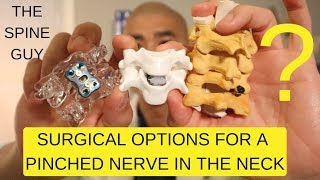 CERVICAL STENOSIS RADICULOPATHY  PART 3  SURGICAL OPTIONS [upl. by Keyek]